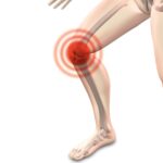 慢性関節リウマチによる肘と膝の痛みが軽減